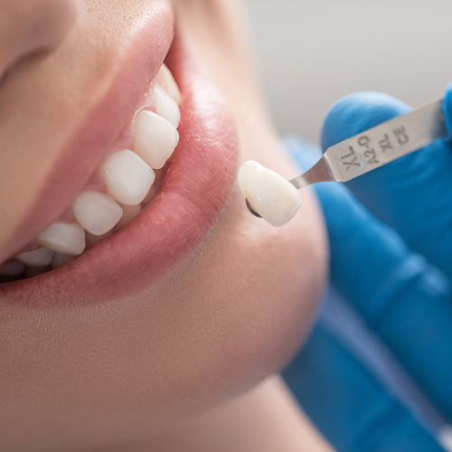 Tamworth Oral Health and Dental Care | Crowns