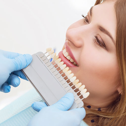 Tamworth Oral Health and Dental Care | Bleaching